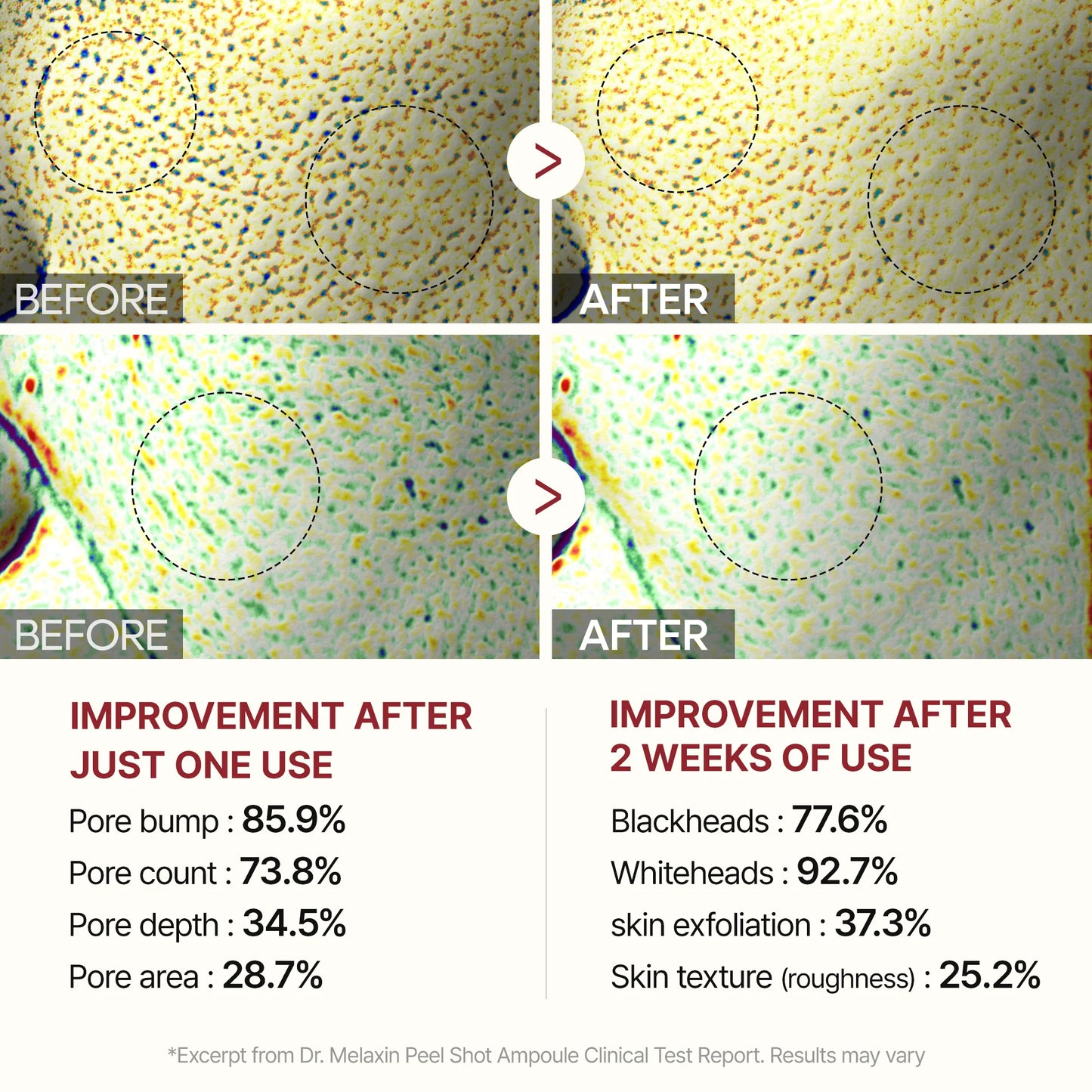 K-Beauty Glow Secret – Dr. Melaxin Peel Shot Glow Rice Line