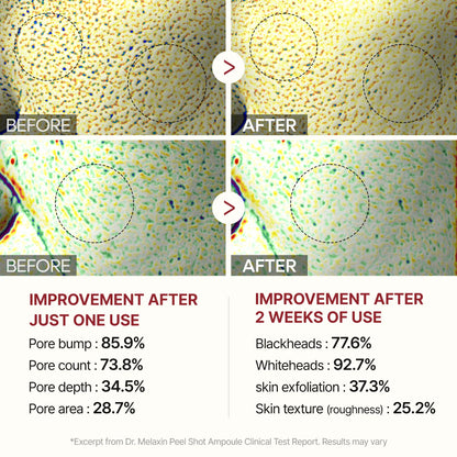 K-Beauty Glow Secret – Dr. Melaxin Peel Shot Glow Rice Line